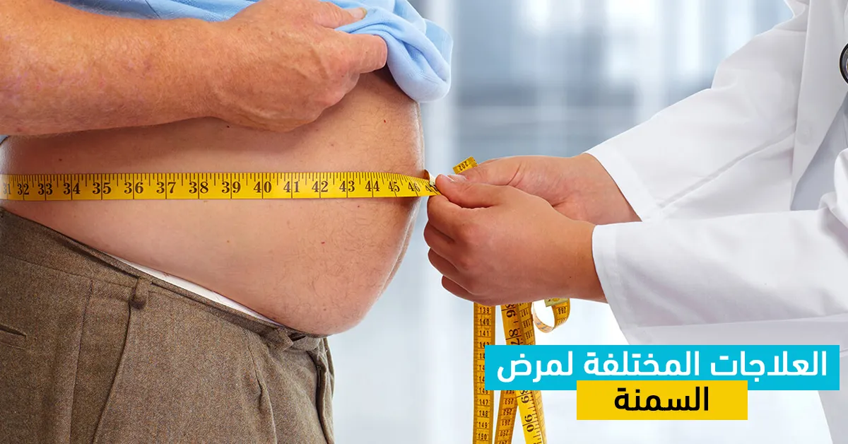 العلاجات المختلفة لمرض السمنة